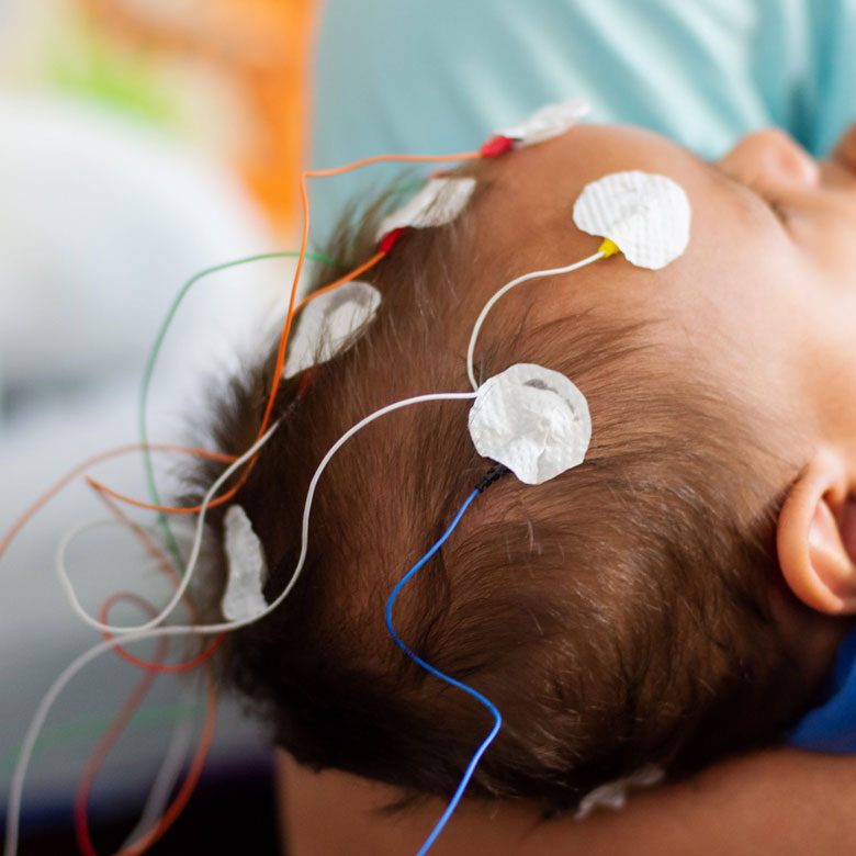 EEG & Neurophysiology